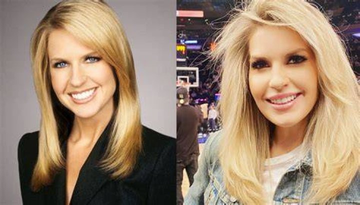 Did Monica Crowley Have Plastic Surgery? Everything You Need To Know