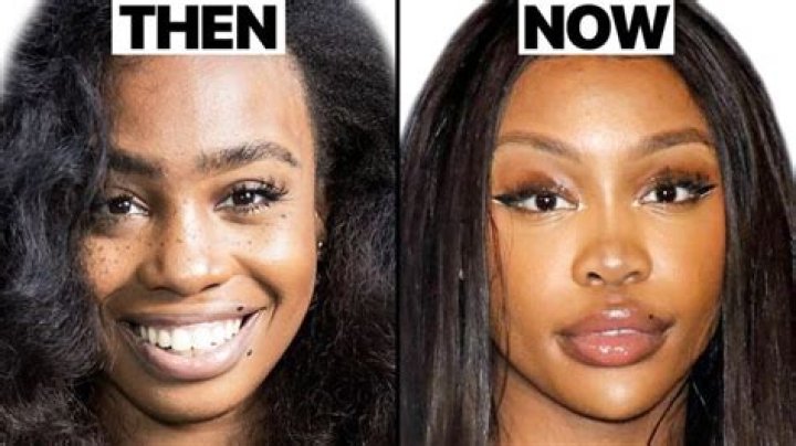 Groundbreaking Discoveries And Insights In SZA Surgery
