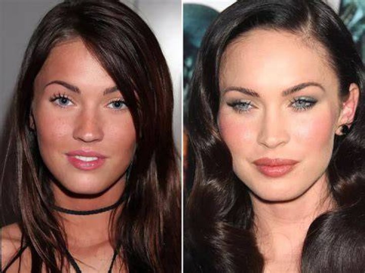 Megan Fox Before and After Plastic Surgery A Tale of Evolution ASEAN TV