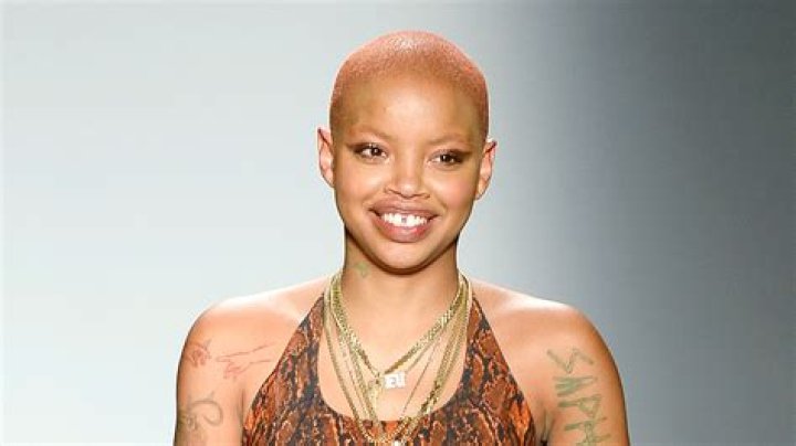 Model Slick Woods Shares Smiling Update After Seizure Allure