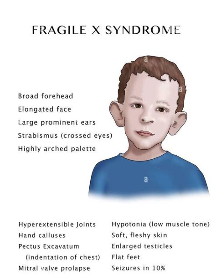 syndrome feature MEDizzy