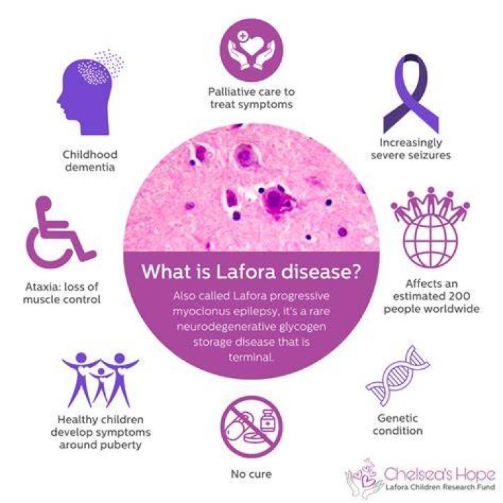 Unraveling The Enigma Of Lafora Disease